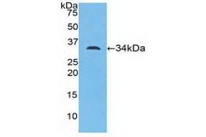 Detection of Recombinant MYO1D, Mouse using Polyclonal Antibody to Myosin ID (MYO1D) (Myosin ID Antikörper  (AA 581-847))
