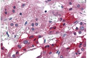 anti-Metalloproteinase Inhibitor 2 (TIMP2) antibody