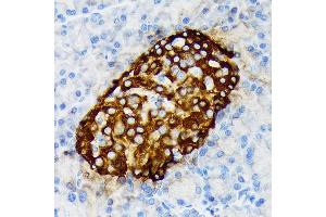 Immunohistochemistry of paraffin-embedded rat pancreatic islet using Chromogranin A Rabbit mAb (ABIN7266366) at dilution of 1:100 (40x lens). (Chromogranin A Antikörper)