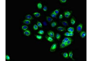 Immunofluorescent analysis of A549 cells using ABIN7171373 at dilution of 1:100 and Alexa Fluor 488-congugated AffiniPure Goat Anti-Rabbit IgG(H+L) (CD1c Antikörper  (AA 18-302))