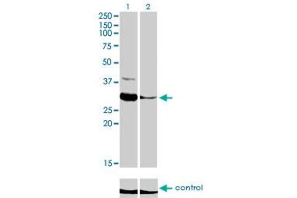 ZNF215 Antikörper  (AA 1-304)