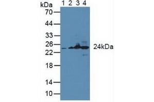 Figure. (GSTK1 Antikörper  (AA 19-222))