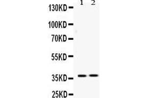 Western Blotting (WB) image for anti-Hepatoma-Derived Growth Factor (HDGF) (AA 61-97), (C-Term) antibody (ABIN4886613)