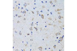 Immunohistochemistry of paraffin-embedded mouse brain using PTPN1 antibody. (PTPN1 Antikörper)