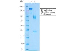 SDS-PAGE analysis of purified, BSA-free recombinant MART-1 antibody (clone MLANA/1409R) as confirmation of integrity and purity.
