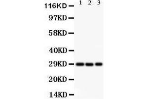 Western Blotting (WB) image for anti-Kv Channel Interacting Protein 3, Calsenilin (KCNIP3) (AA 1-16), (N-Term) antibody (ABIN3042562)