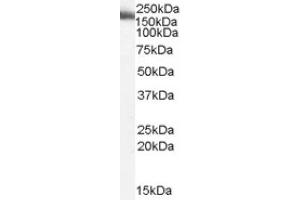 Image no. 1 for anti-Myosin IXB (MYO9B) (Internal Region) antibody (ABIN374691) (MYO9B Antikörper  (Internal Region))