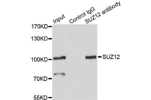 Immunoprecipitation analysis of 200ug extracts of HeLa cells using 3ug SUZ12 antibody. (SUZ12 Antikörper)