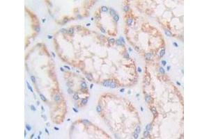 IHC-P analysis of Human Tissue, with DAB staining. (Cyclin D1 Antikörper  (AA 1-295))