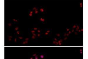 Immunofluorescence analysis of HeLa cells using PCNA Polyclonal Antibody at dilution of 1:100. (PCNA Antikörper)