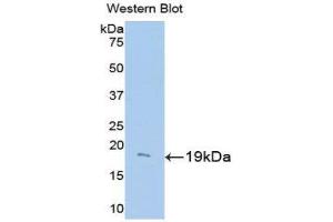 Western Blotting (WB) image for anti-Uncoupling Protein 2 (Mitochondrial, Proton Carrier) (UCP2) (AA 150-304) antibody (ABIN3205057) (UCP2 Antikörper  (AA 150-304))