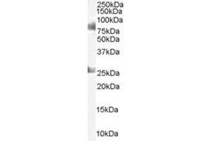 Image no. 1 for anti-Chromodomain Protein, Y-Like (CDYL) (C-Term) antibody (ABIN374294) (CDYL Antikörper  (C-Term))
