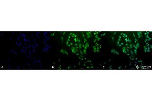 Immunofluorescence (fixed cells) (IF/ICC) image for anti-Ubiquitin (Ub) antibody (Atto 594) (ABIN2481448)