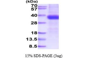 SDS-PAGE (SDS) image for Kallikrein-Related Peptidase 15 (KLK15) (AA 17-256) protein (His tag) (ABIN6388017) (Kallikrein 15 Protein (AA 17-256) (His tag))