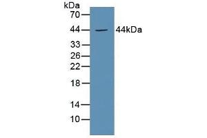 Detection of EP3 in Mouse Kidney Tissue using Polyclonal Antibody to Prostaglandin E Receptor 3 (EP3) (PTGER3 Antikörper  (AA 217-390))