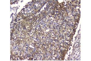 IHC analysis of NMI using anti-NMI antibody (ABIN3043451). (NMI Antikörper  (AA 2-307))