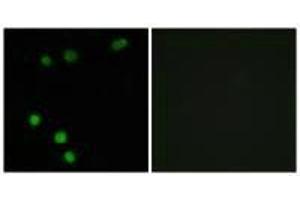 Immunofluorescence analysis of MCF-7 cells, using TP53INP2 antibody. (TP53INP2 Antikörper)