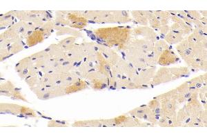 Detection of CGRP in Mouse Cardiac Muscle Tissue using Polyclonal Antibody to Calcitonin Gene Related Peptide (CGRP) (CGRP Antikörper  (AA 1-130))