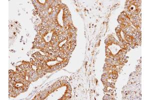 IHC-P Image Immunohistochemical analysis of paraffin-embedded human endo mitrial, using CCNDBP1, antibody at 1:100 dilution. (CCNDBP1 Antikörper  (C-Term))