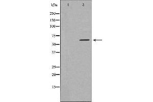 Western blot analysis of extracts from HeLa cells, using TBC1D3 antibody. (TBC1D3 Antikörper)