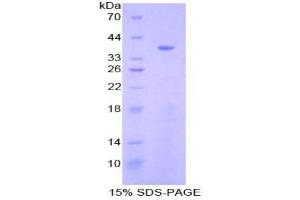 SDS-PAGE analysis of Human Cytovillin Protein. (Ezrin Protein (EZR))