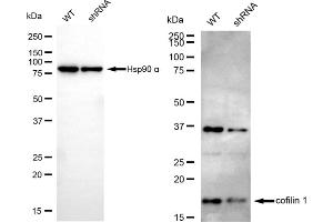 Western blotting analysis using cofilin 1 antibody (ABIN7798111).