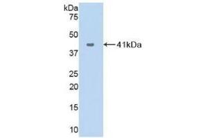 Detection of Recombinant VCC1, Human using Polyclonal Antibody to VEGF Co Regulated Chemokine 1 (VCC1) (CXCL17 Antikörper  (AA 24-119))