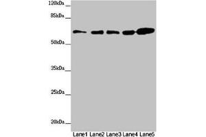 Western blot All lanes: ZBTB46 antibody at 2 μg/mL Lane 1: Mouse heart tissue Lane 2: Mouse liver tissue Lane 3: Mouse kidney tissue Lane 4: 293T whole cell lysate Lane 5: SH-SY5Y whole cell lysate Secondary Goat polyclonal to rabbit IgG at 1/10000 dilution Predicted band size: 65 kDa Observed band size: 65 kDa (ZBTB46 Antikörper  (AA 174-362))