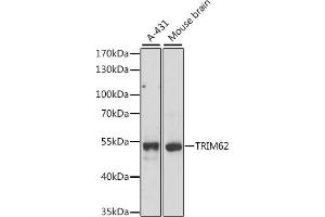 Western blot analysis of extracts of various cell lines, using TRIM62 antibody (ABIN7270996) at 1:1000 dilution. (TRIM62 Antikörper  (AA 120-280))