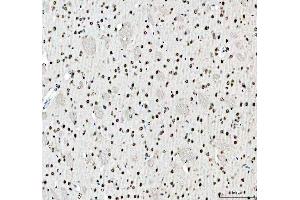 IHC analysis of SFPQ using anti-SFPQ antibody (ABIN7603089). (SFPQ Antikörper  (Middle Region))