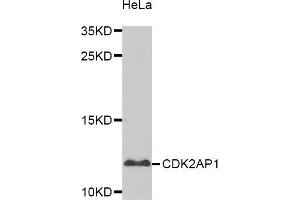 Western Blotting (WB) image for anti-Cyclin-Dependent Kinase 2 Associated Protein 1 (CDK2AP1) antibody (ABIN1871723)