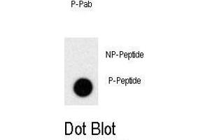 Dot blot analysis of anti-Phospho-PRL-p Antibody (ABIN389956 and ABIN2839758) on nitrocellulose membrane. (Prolactin Antikörper  (pSer163))