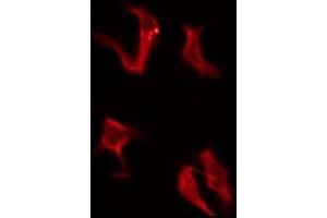 ABIN6276146 staining COLO205 by IF/ICC. (OR4A16 Antikörper  (C-Term))