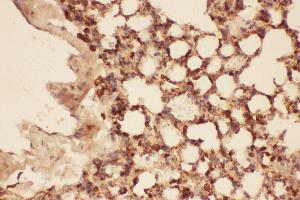 Anti-Cofilin Picoband antibody,  IHC(P): Mouse Lung Tissue (Cofilin Antikörper  (AA 2-166))