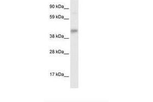 Image no. 1 for anti-SEC14-Like 2 (SEC14L2) (AA 245-294) antibody (ABIN6735907)