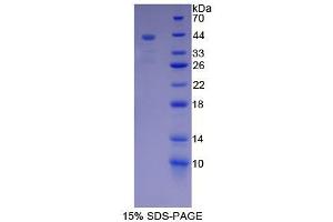SDS-PAGE analysis of Rat Mucin 5B Protein. (MUC5B Protein)