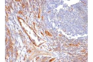 Formalin-fixed, paraffin-embedded human Tonsil stained with CD31 Mouse Monoclonal Antibody (C31. (CD31 Antikörper)