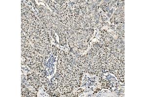IHC analysis of JUNB using anti-JUNB antibody (ABIN7603223). (JunB Antikörper  (N-Term))