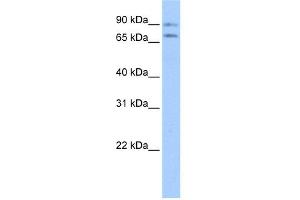 WB Suggested Anti-JPH2 Antibody Titration:  0. (Junctophilin 2 Antikörper  (Middle Region))