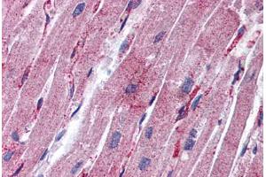 Human Heart: Formalin-Fixed, Paraffin-Embedded (FFPE) (MYL9 Antikörper  (C-Term))