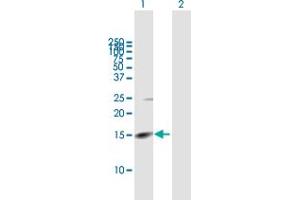 Western Blot analysis of RHBDL2 expression in transfected 293T cell line by RHBDL2 MaxPab polyclonal antibody. (RHBDL2 Antikörper  (AA 1-121))