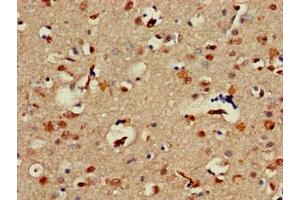 Immunohistochemistry of paraffin-embedded human brain tissue using ABIN7143961 at dilution of 1:100 (ALX1 Antikörper  (AA 10-304))