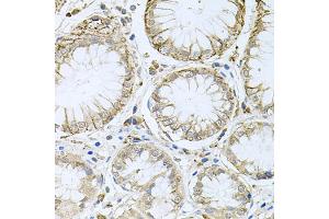 Immunohistochemistry of paraffin-embedded human stomach using HPS1 antibody (ABIN5973982) at dilution of 1/100 (40x lens).