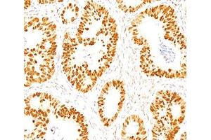 IHC staining of normal colon with p53 antibody (DO-7). (p53 Antikörper  (AA 20-25))