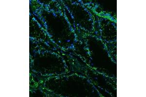 IF analysis of Claudin18/CLDN18 using anti-Claudin18/CLDN18 antibody (ABIN7601257). (Claudin 18 Antikörper  (AA 31-261))