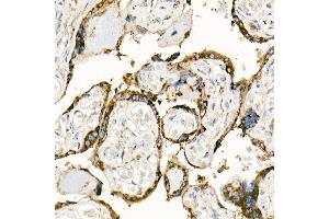 Immunohistochemistry (IHC) image for anti-Fas Ligand (TNF Superfamily, Member 6) (FASL) (AA 100-200) antibody (ABIN3020742)