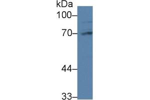 Detection of PABPC1L in Rat Liver lysate using Polyclonal Antibody to Poly A Binding Protein Cytoplasmic 1 Like Protein (PABPC1L) (PABPC1L Antikörper  (AA 514-612))