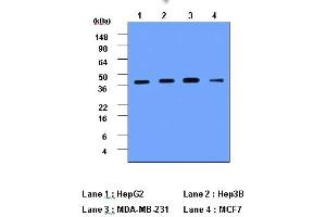 Western Blotting (WB) image for anti-Cathepsin D (CTSD) (AA 21-412) antibody (ABIN317502) (Cathepsin D Antikörper  (AA 21-412))