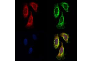 ABIN6257718 and ABIN6275927 staining Hela cells by IF/ICC. (CysLTR1 Antikörper  (Internal Region))