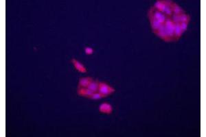 Immunofluorecence staining of GPC3 polyclonal antibody  on HepG2 cells . (Glypican 3 Antikörper  (AA 530-560))